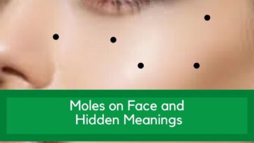 Moles on Face & Their Hidden Meanings